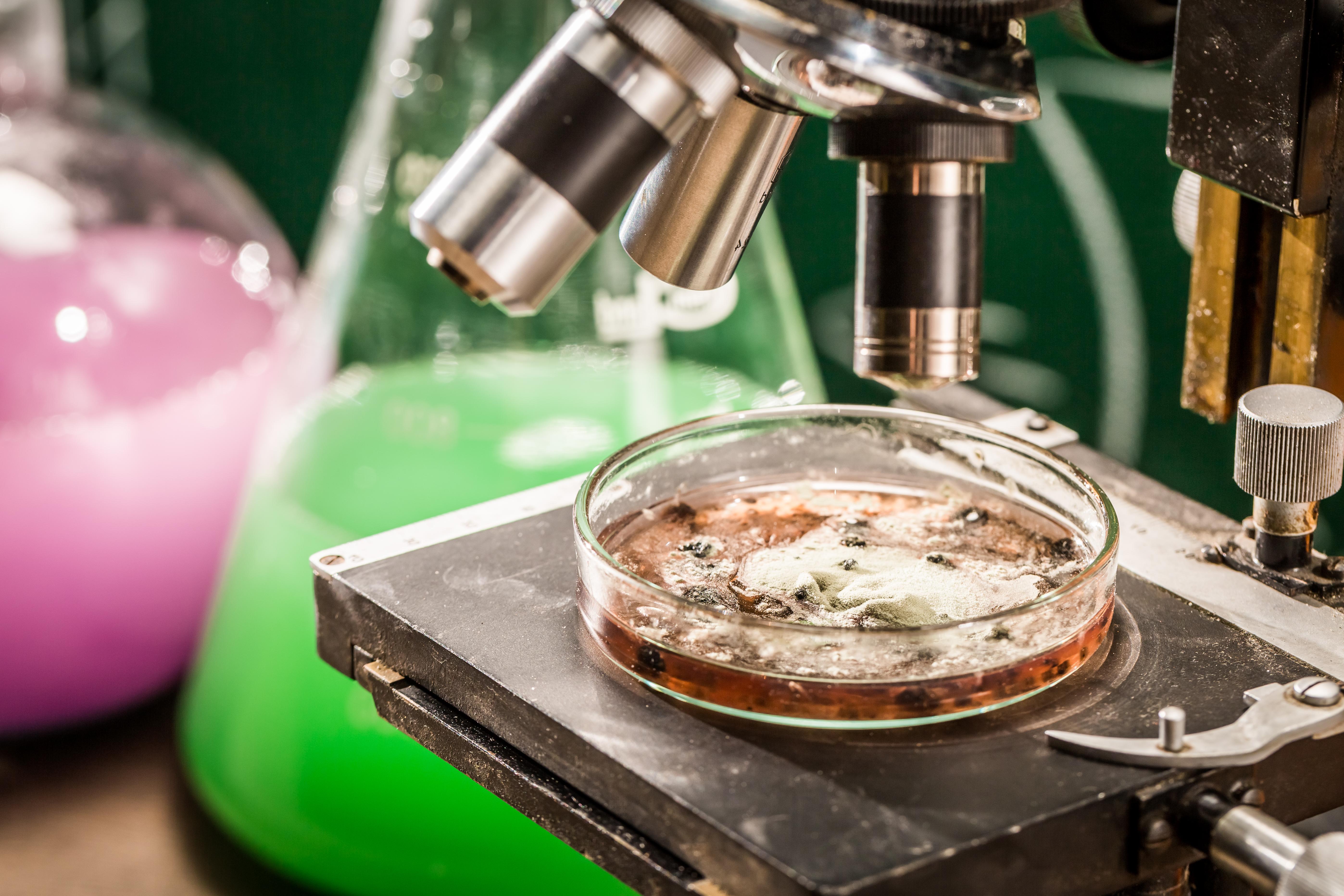 sem/toxicity-test-of-molds-in-laboratory